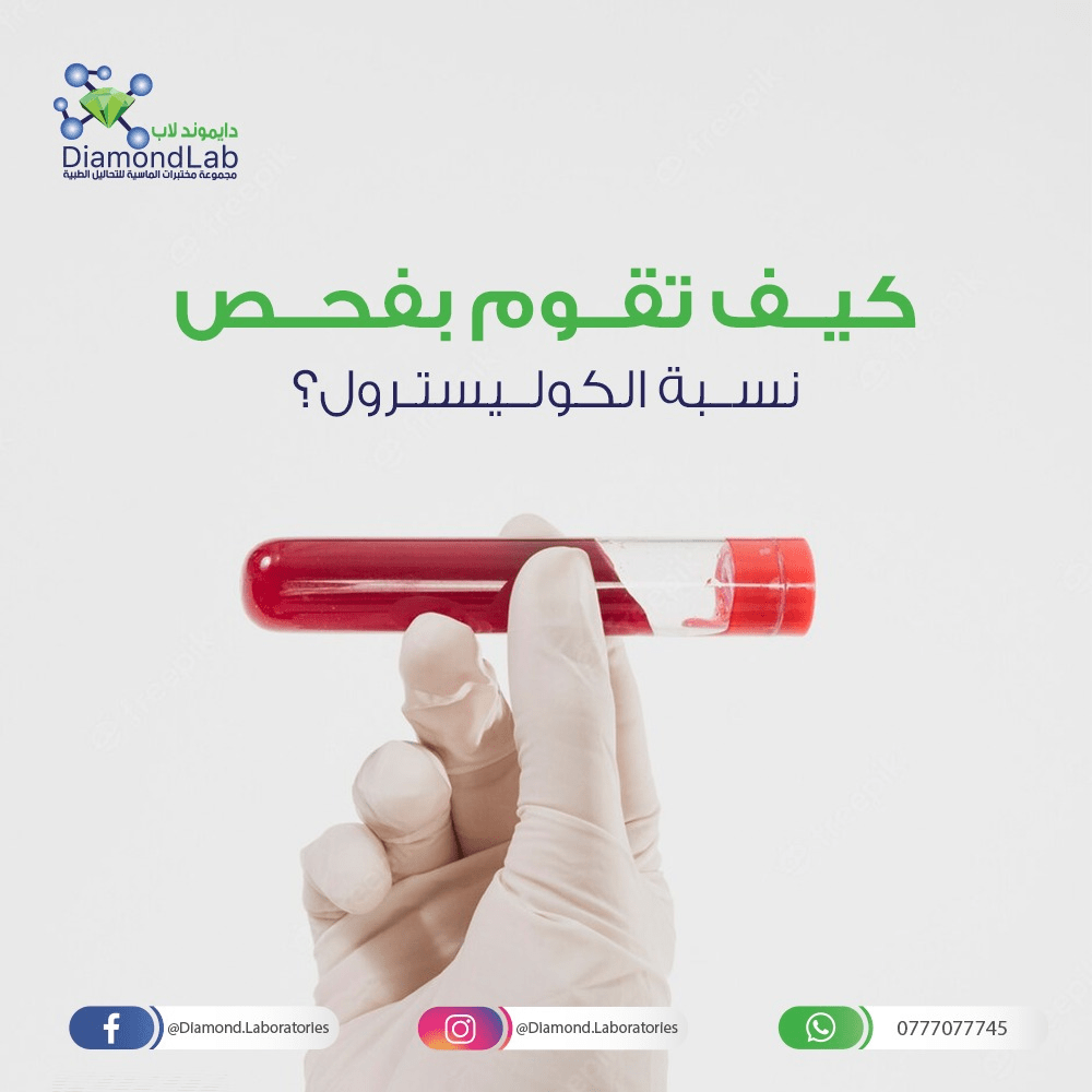 كيف يمكن فحص الكوليسترول الضار