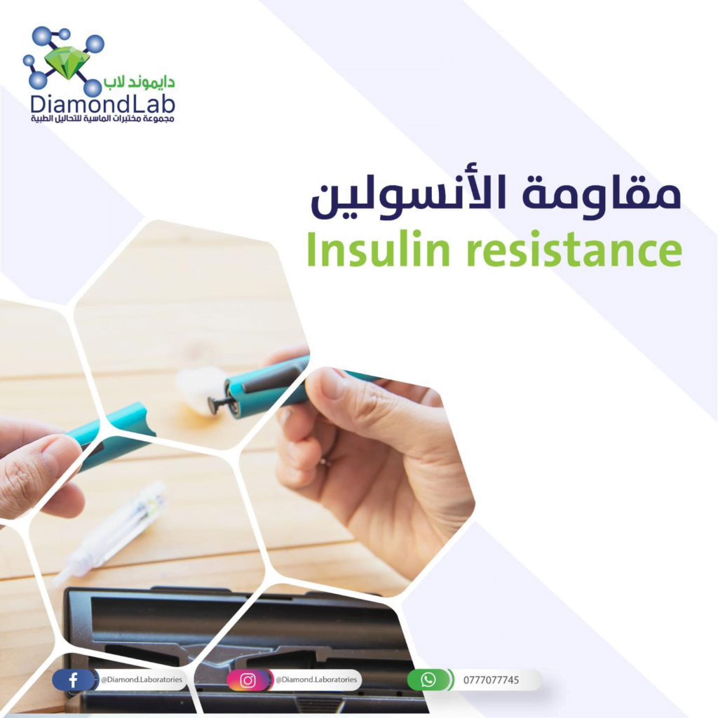 مقاومة الأنسولين