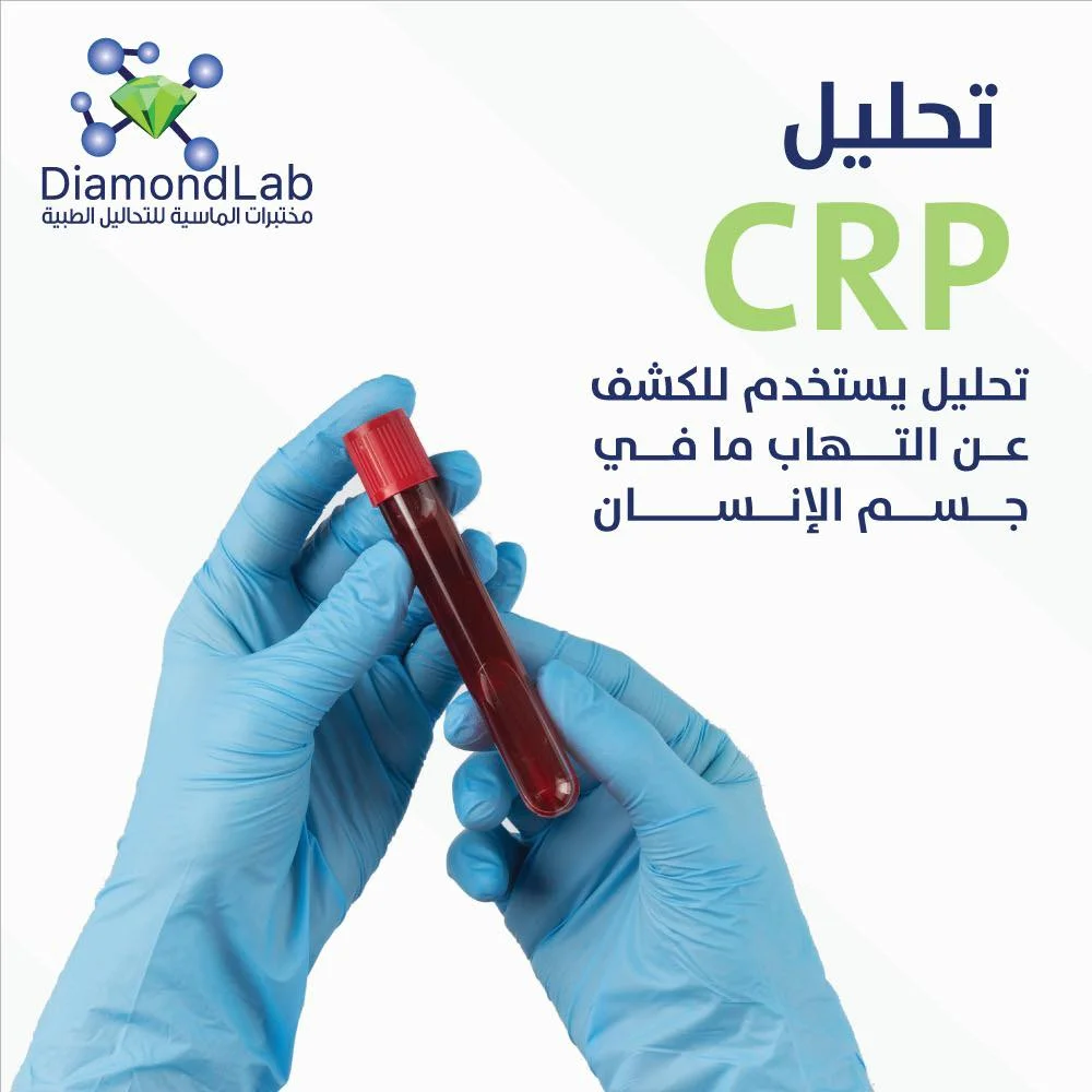 فحص CRP