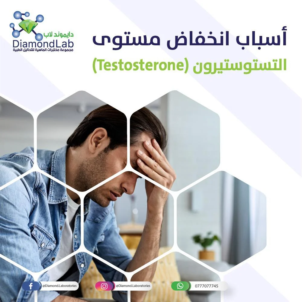 أسباب انخفاض هرمون التستوستيرون