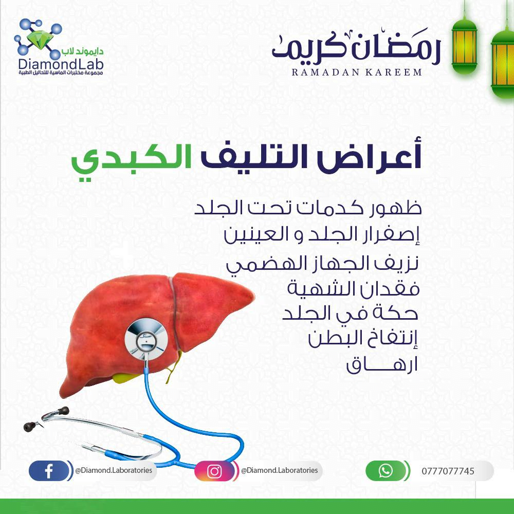 تشمع الكبد| الأسباب الأعراض وطرق الوقاية