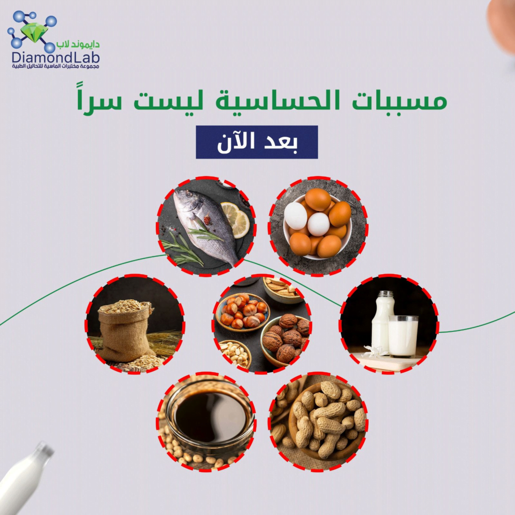 أكثر الأطعمة التي تسبب الحساسية