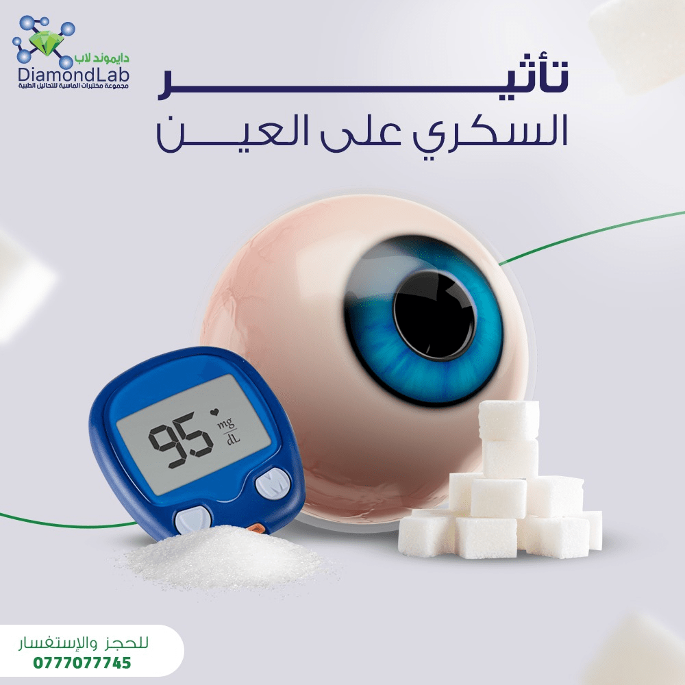 تأثير السكري على العين
