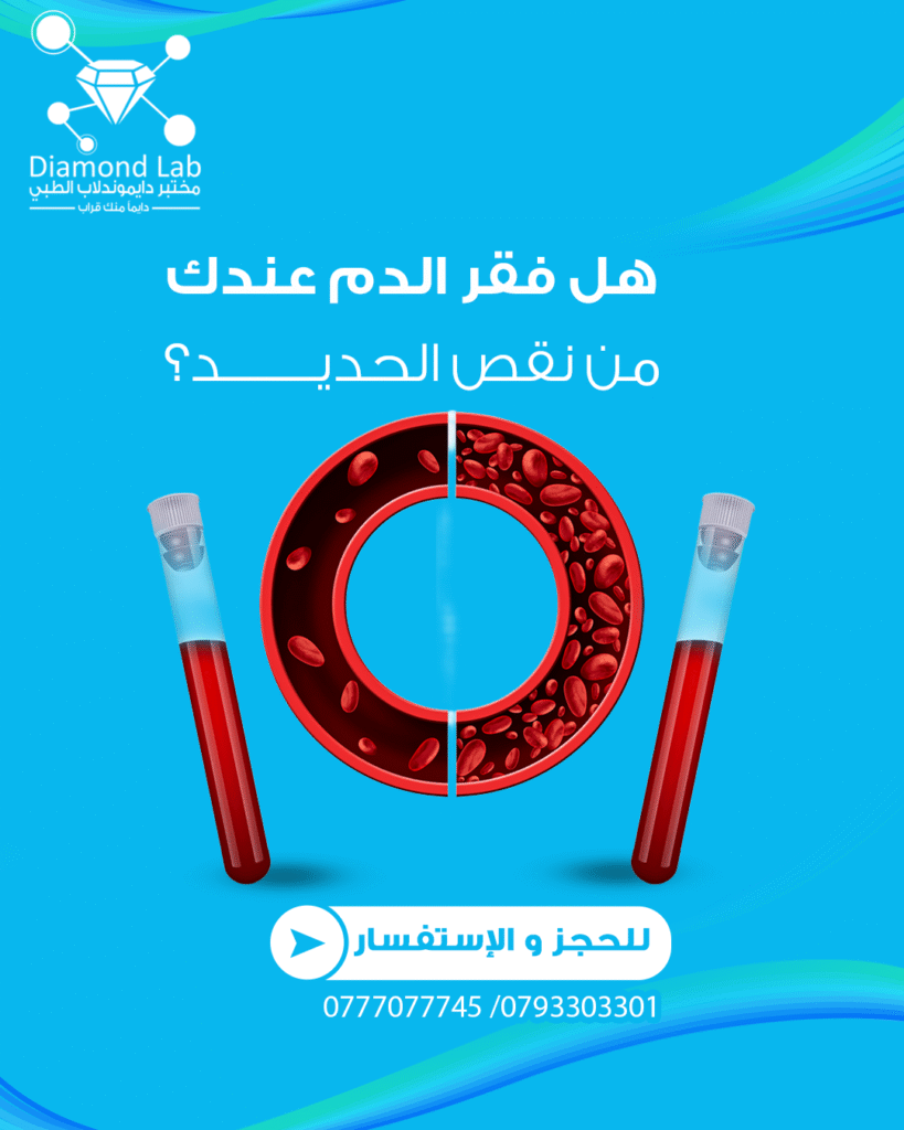 ما هي أسباب فقر الدم الناتج عن نقص الحديد؟