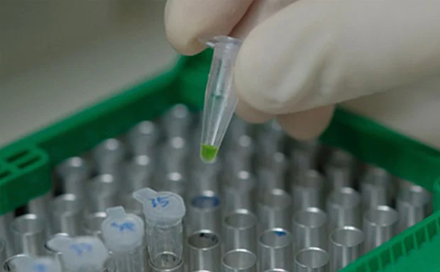 يشرح دايموندلاب كيف يتم عمل تحليل PCR داخل المختبر الطبي.