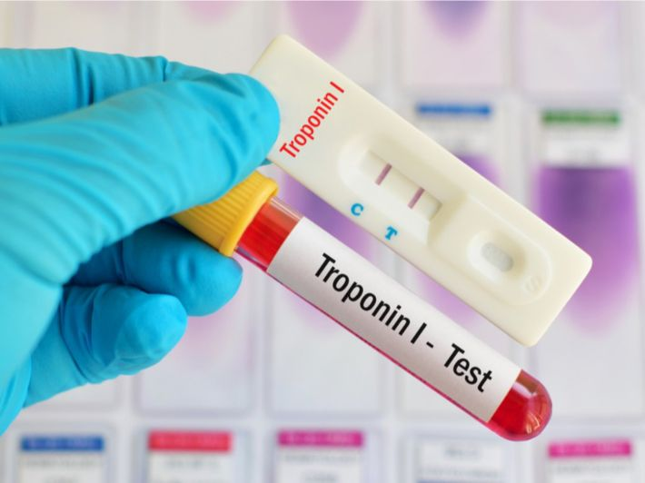 متى يتم طلب إجراء فحص تروبونين؟